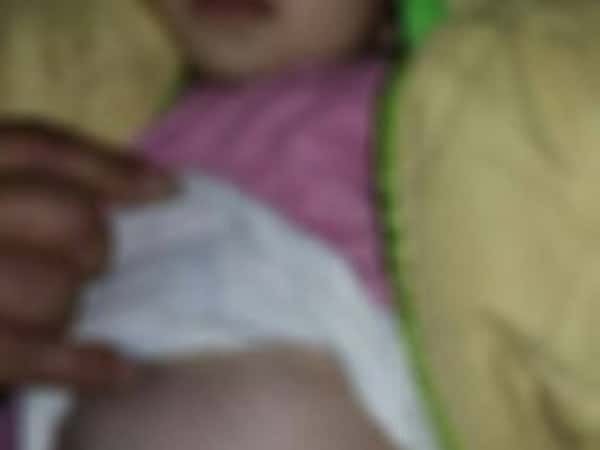 An infant needs help