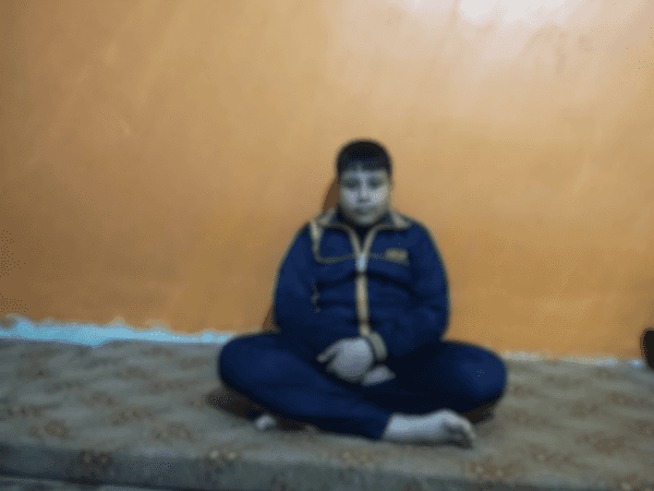 A kid who needs surgery for chronic tonsillitis