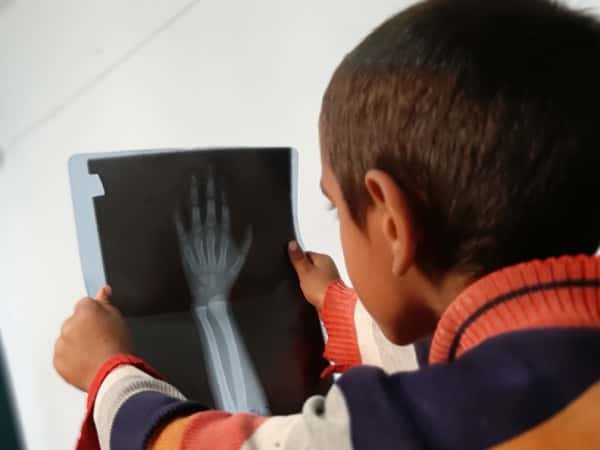 A kid with growth impairment