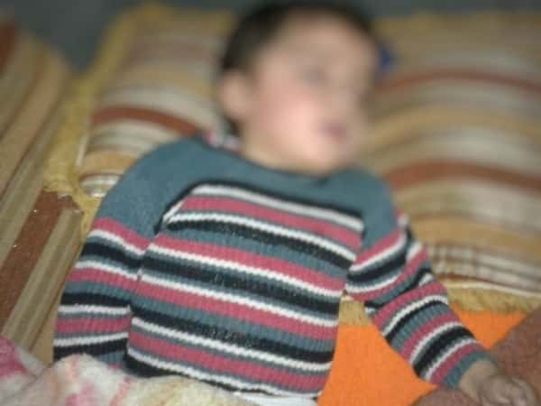 A child with congenital cerebral atrophy