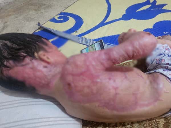 الحالات الإنسانية المستعجلة