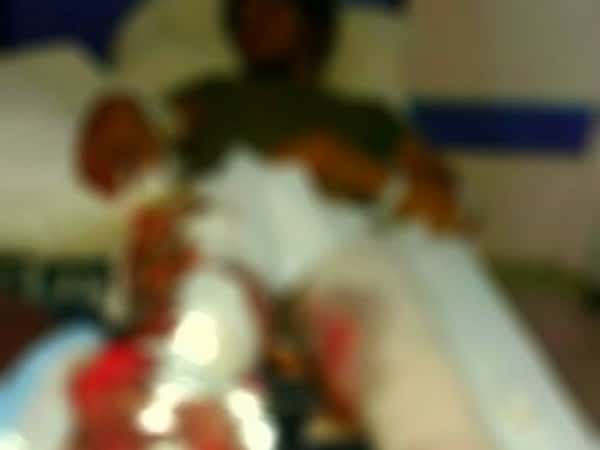 Treatment expenses for a young man