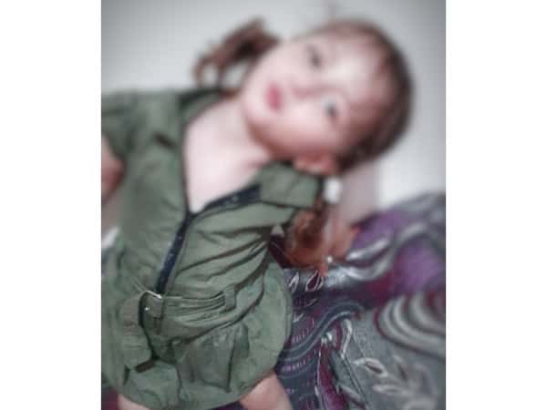 A girl with Congenital hip dislocation