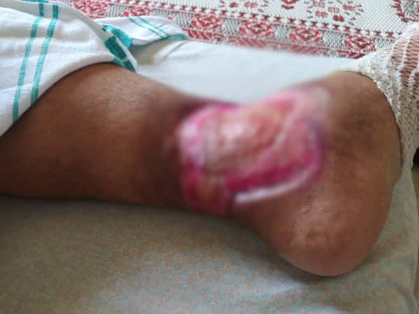 Brother Omar Needs Help!!
