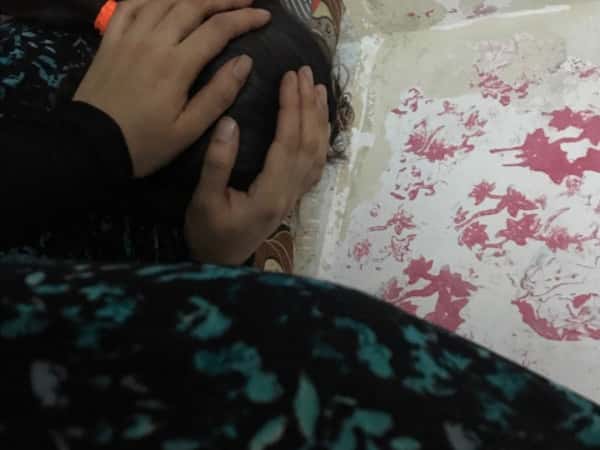 مريضة بحاجة لإستئصال ثدي