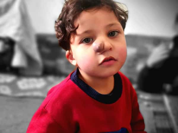 Imad is a child who needs urgent surgery! He needs your help!