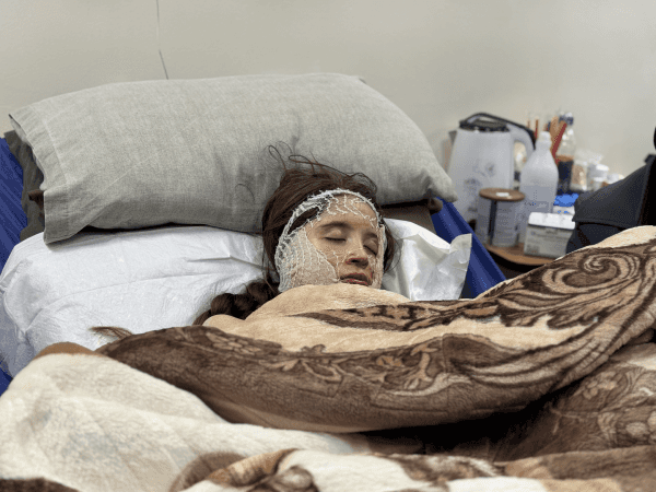 Burns Covering Little Rama’s Face