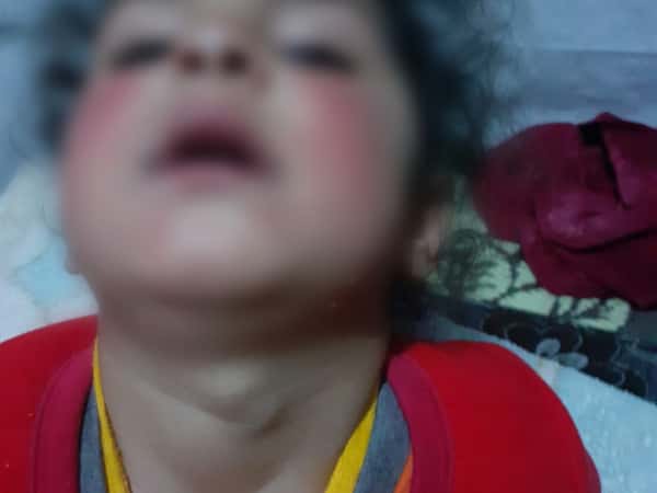 طفلة يتيمة بحاجة لعمل جراحي!