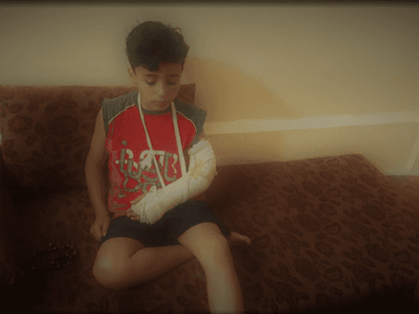 Zain; a kid who broke his forearm