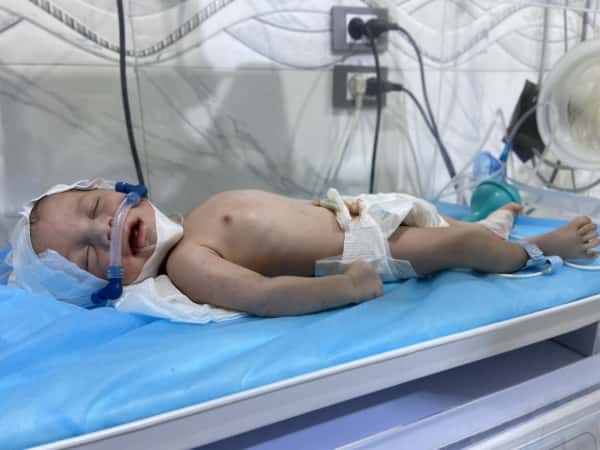 Ghiath is premature baby who needs your help to survive!
