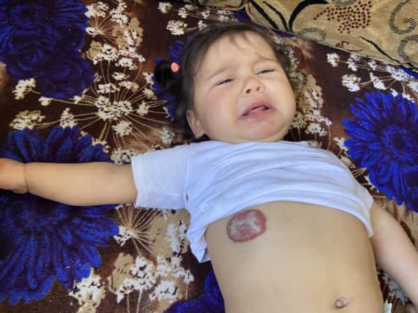 Help baby Aziza live a normal life
