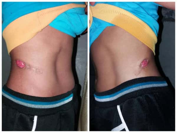 A poor child in sever pain