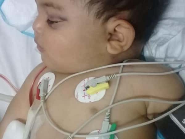 A baby had been brutaly beaten by his father!