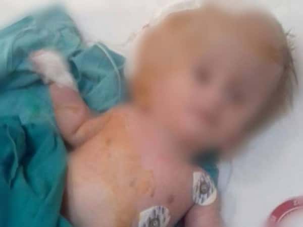 Treatment expenses for a child