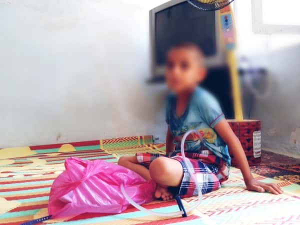 a kid with many diseases