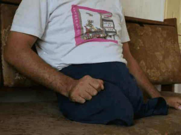 A family whose provider is amputated