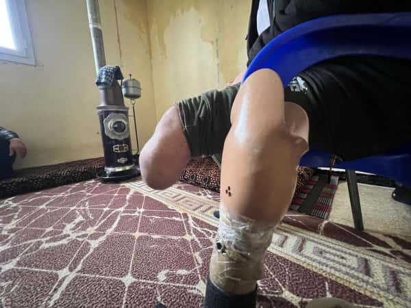 عائلةٌ تتكئ على الألم