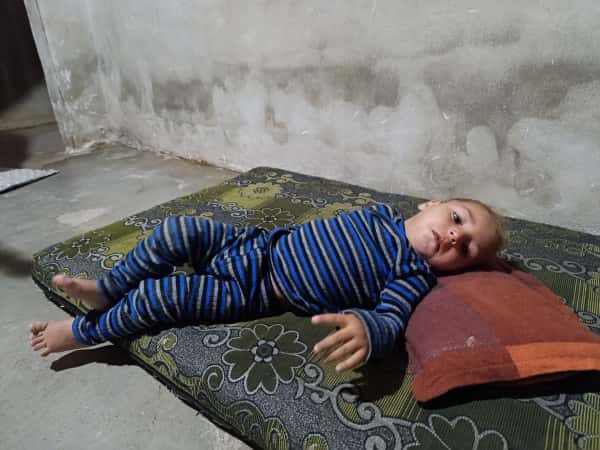 ضمور دماغي أدى لأذية حركية