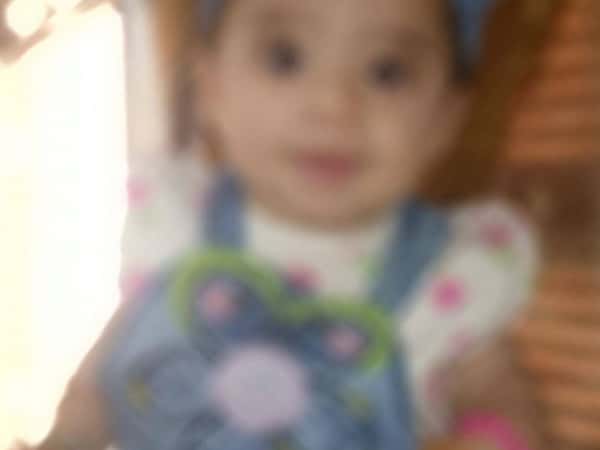 Child needing open heart surgery