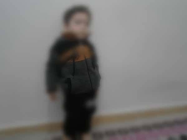 Kid with growth impairement