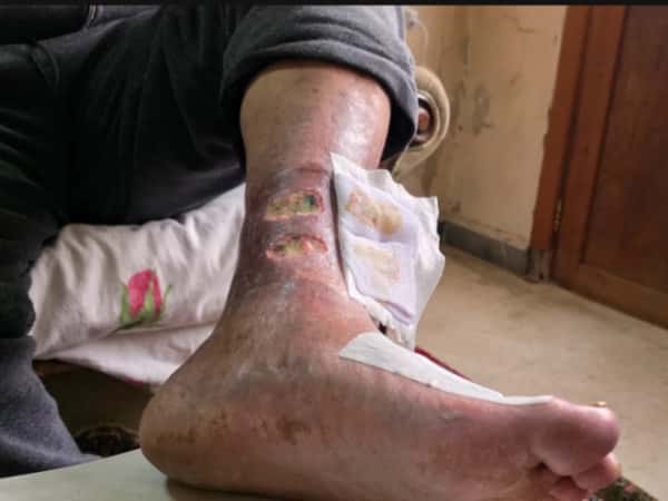 Pain that left the prison but never left the body