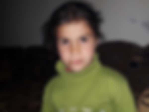Child injured by shelling