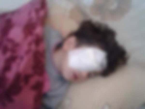 A child in need for eye surgery