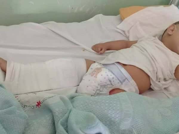 A child needs medical surgery