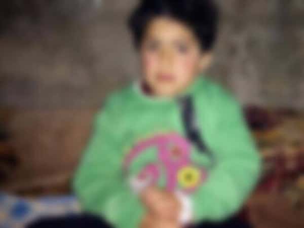 A Child Suffers from Kidney Hypertrophy