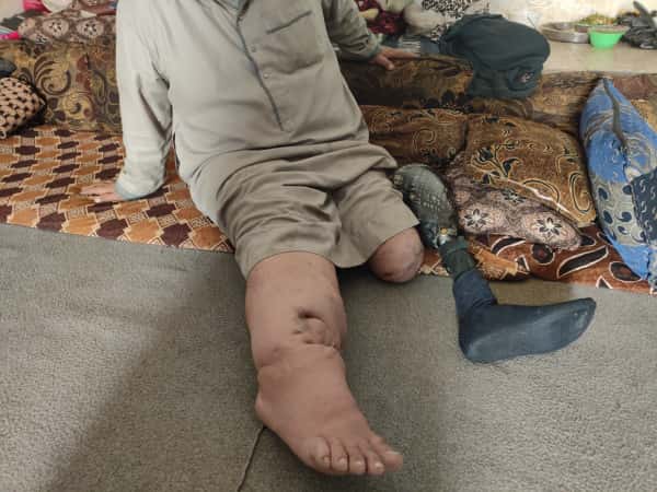 ألمٌ فوق الركام.. وعجزٌ ينهشُ الأمل