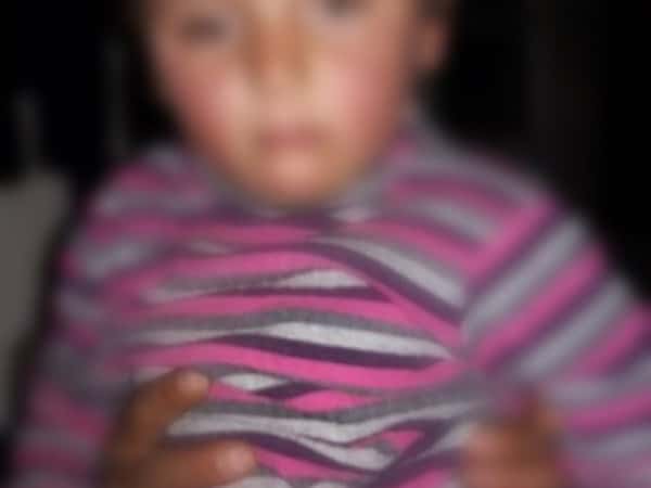 A child with brain cancer
