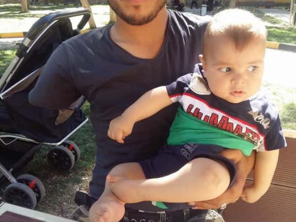 Child needing shoulder surgery