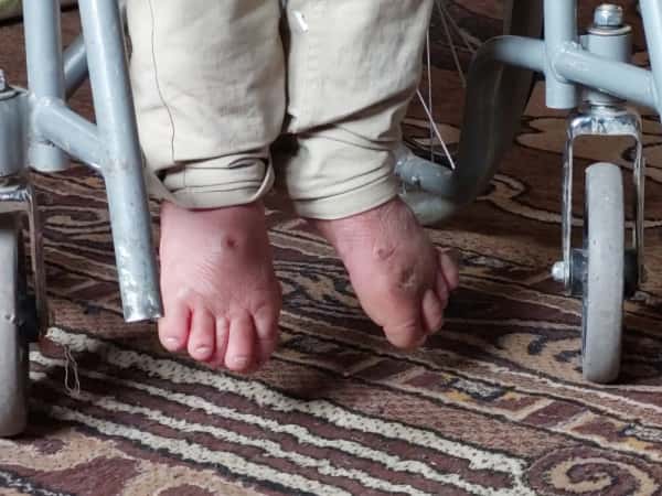 عائشة.. أم ثكلى ترعى يتيميها وحدها