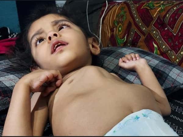 Ghazal and her brother suffer from cerebral atrophy!