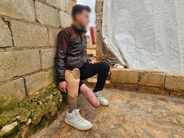 يقاوم على قدمٍ صناعية