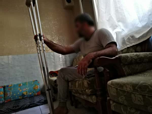 بترت ساقه سابقاً، وفقد عمله مؤخراً