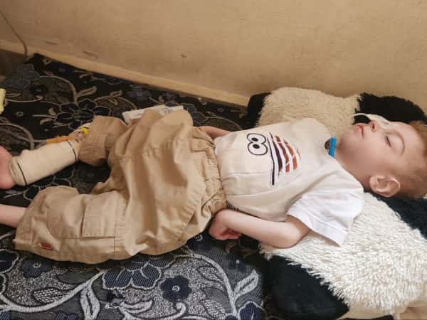 صغيرنا يونس يعاني من ضمور دماغي وبحاجة لرعاية صحية