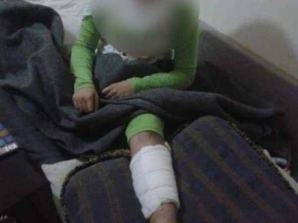A little girl is in desperate need for an operation so that she won't lose a limb !