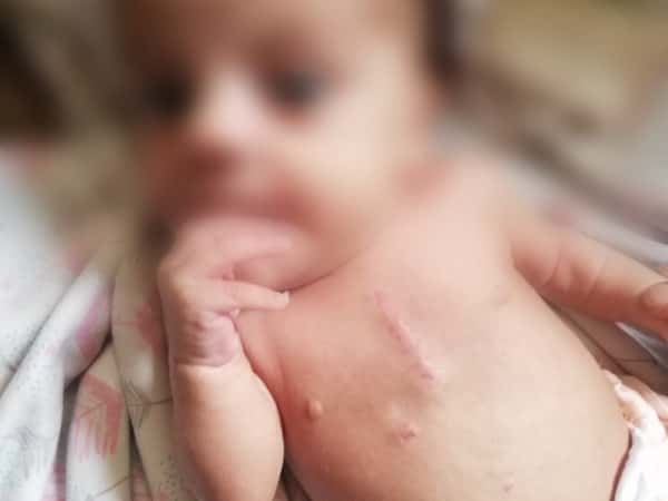 A father suffering from kidney pain and a baby with atrial defect