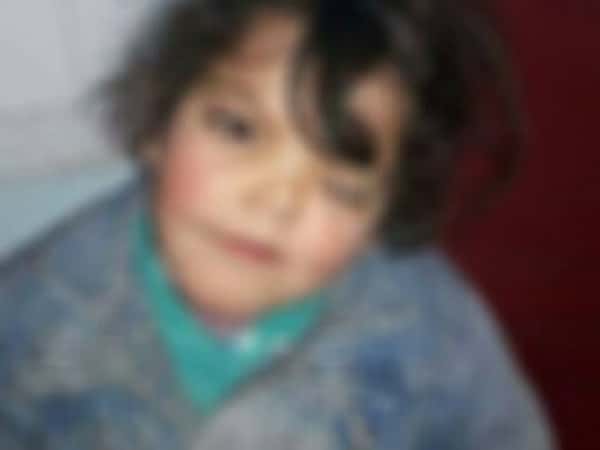 A child needs retinal operation