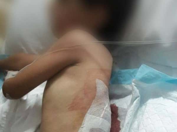 A child needs treatment expenses to be covered