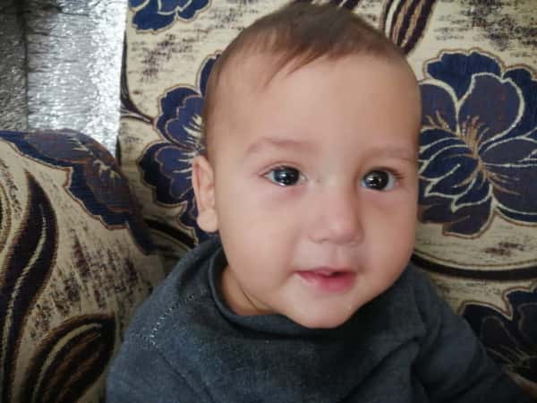 Blocked Tear Duct in Need of Surgery: Help Abdulrahman