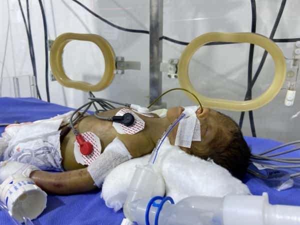 Ayoub's family is waiting for your support so their child can receive treatment and find peace.