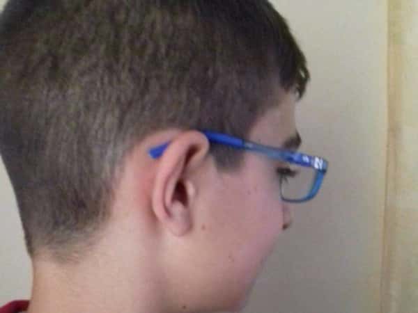 A kid in need of opthalmic surgery
