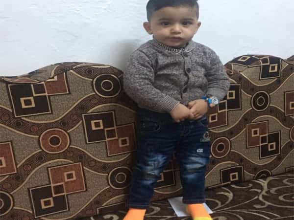 An infant in need for milk special formula and food supplements