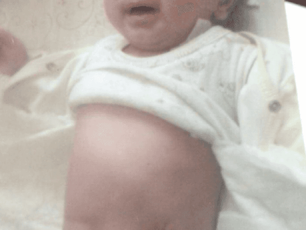 A Child in Need to Undergo a Surgery