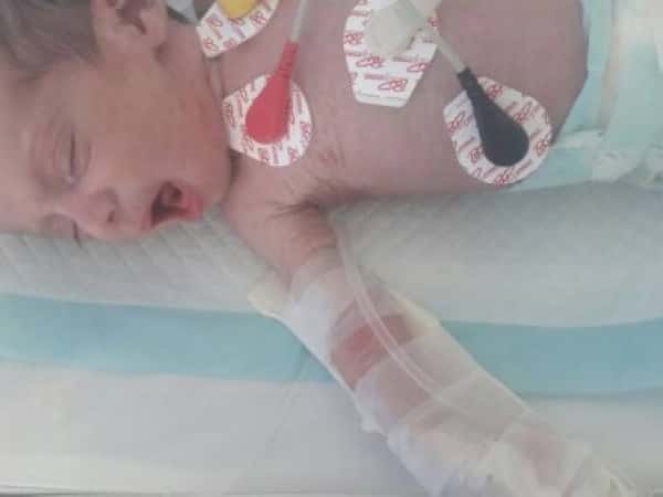 An infant needs admission to emergancy room