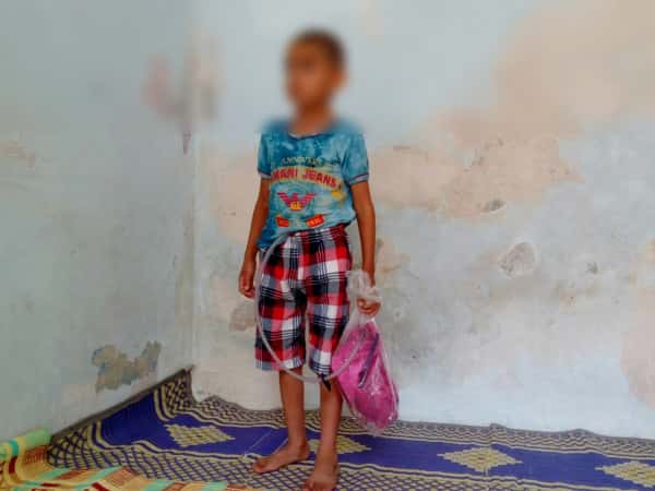 a kid with renal enlargement and failure