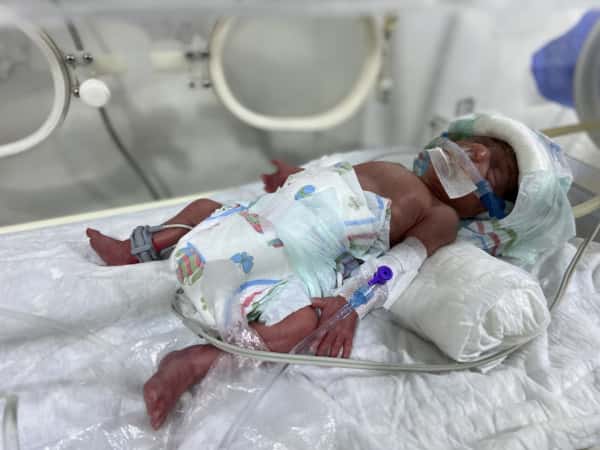 Sind and Ahd, twins born prematurely, need your support to secure their lives.