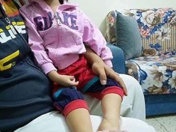Surgery and medical shoes needed for a kid